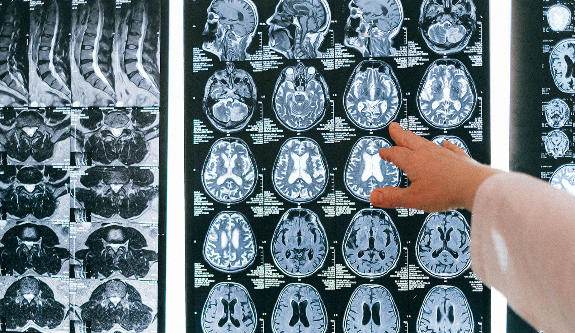 Do IQs Rise With Age?